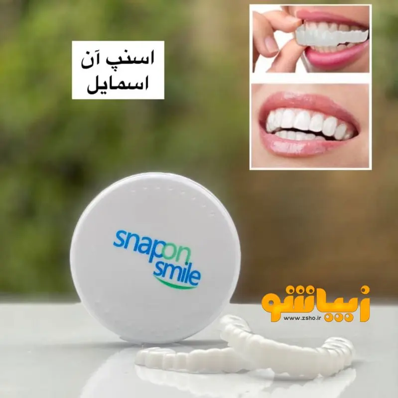 لمینت متحرک دندان اسنپ آن اسمایل Snap On Smile